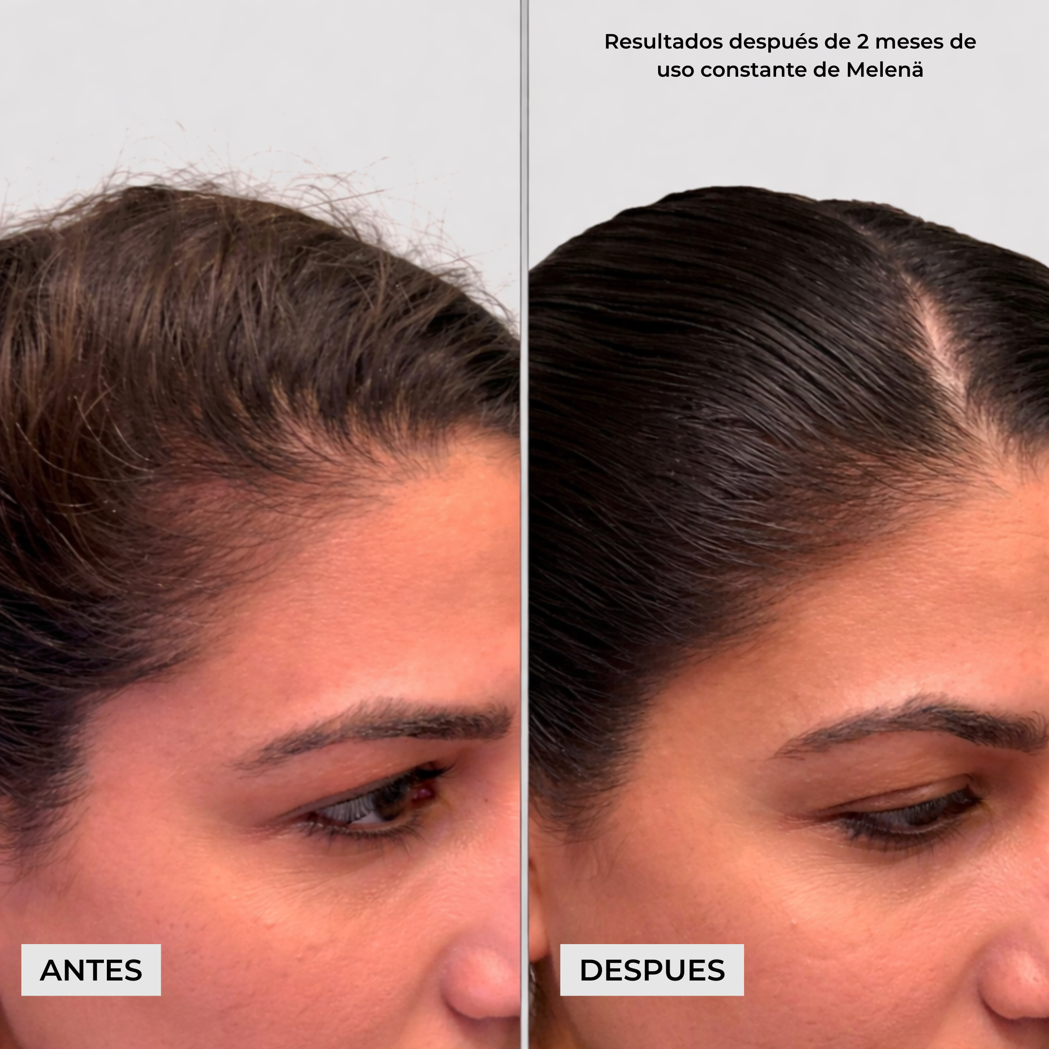 Melenä Crecimiento del Cabello