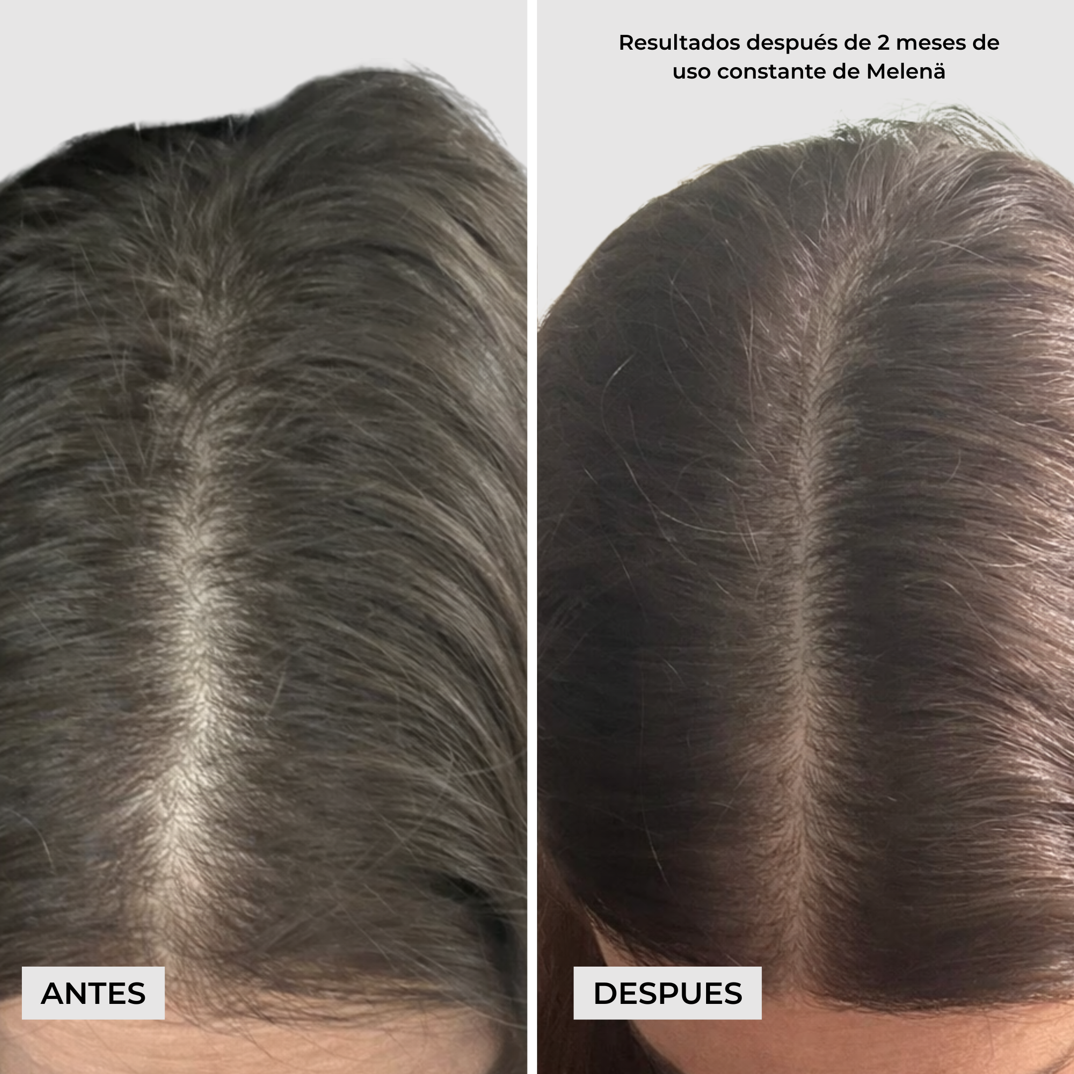 Melenä Crecimiento del Cabello