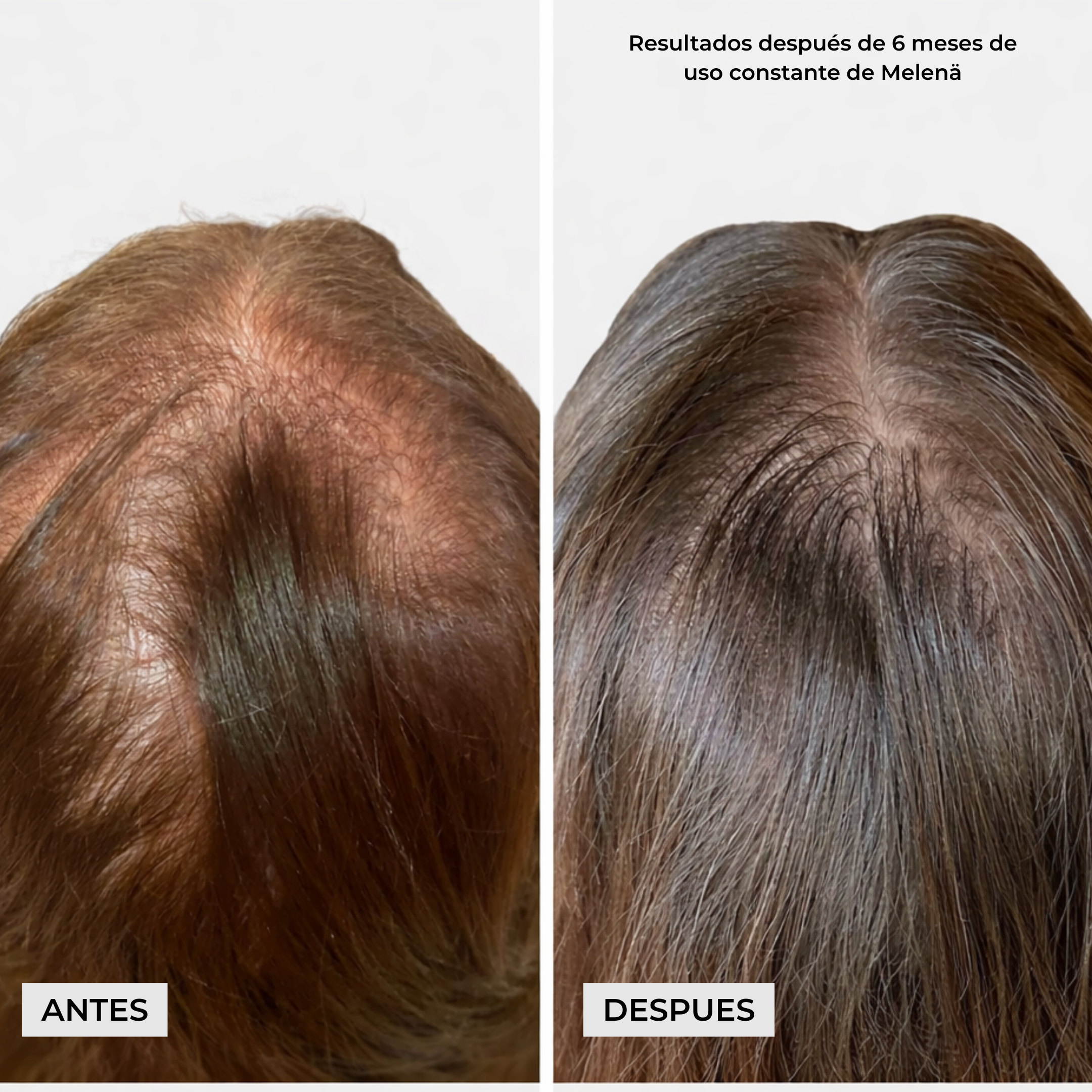 Melenä Crecimiento del Cabello