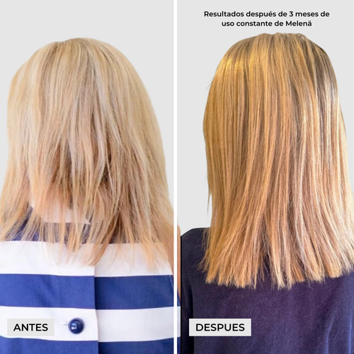 Melenä Crecimiento del Cabello