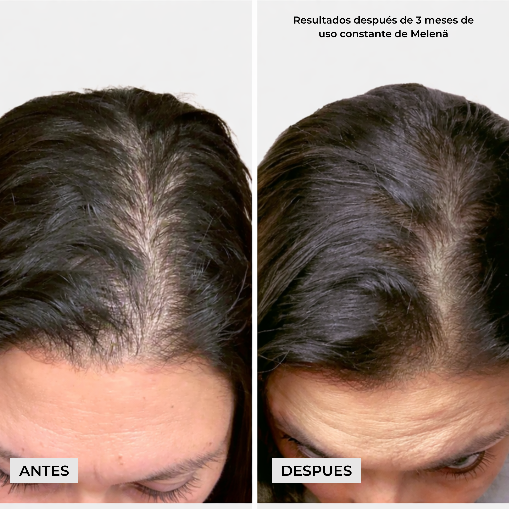 Melenä Crecimiento del Cabello