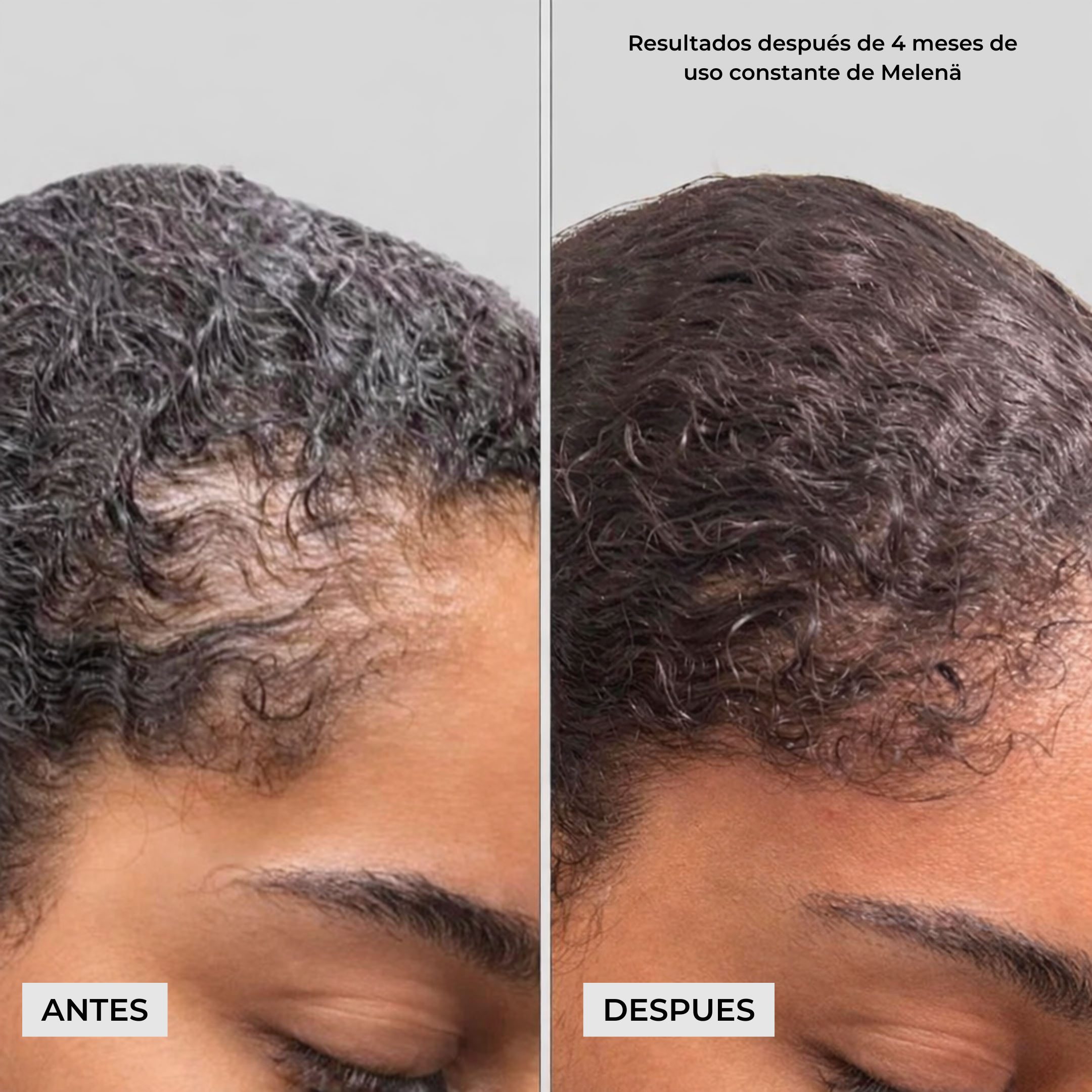 Melenä Crecimiento del Cabello