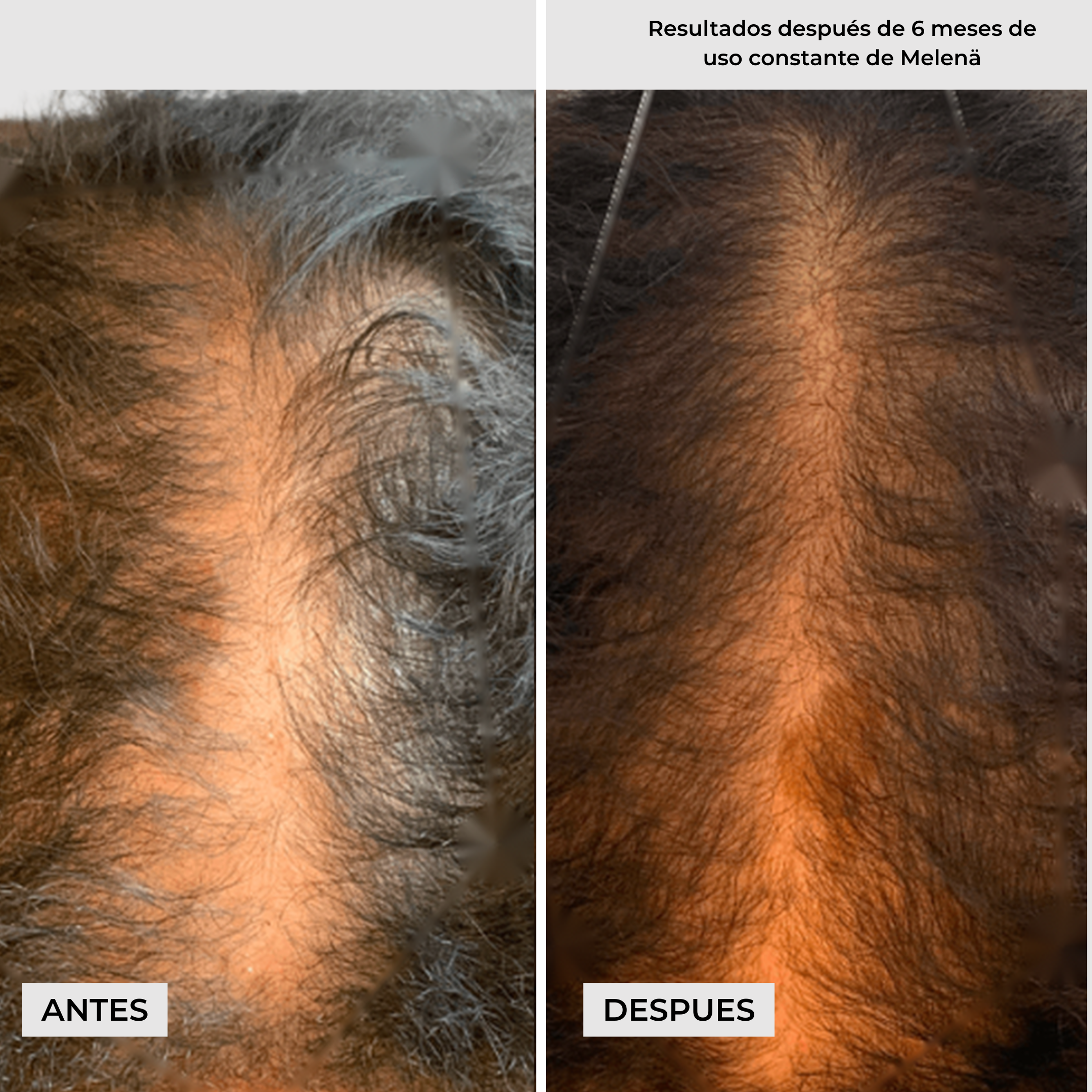 Melenä Crecimiento del Cabello